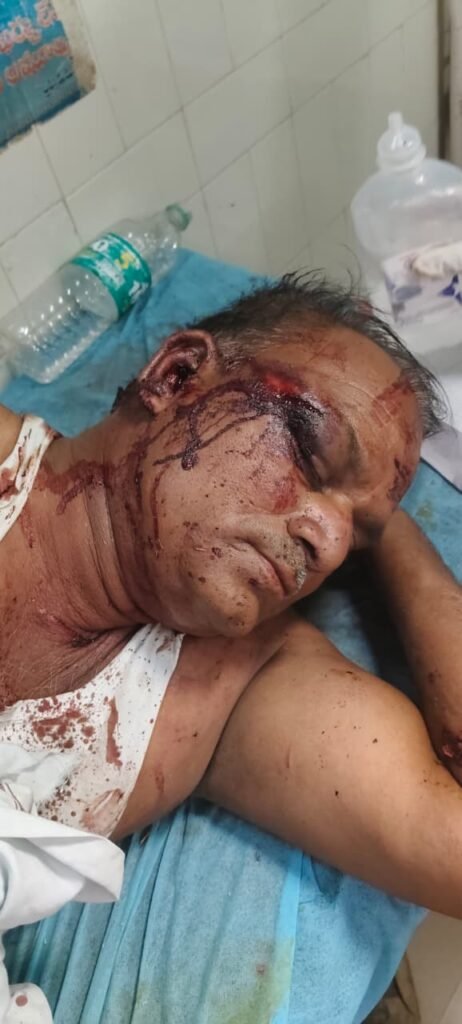 నేరనికి తాండలో రక్తపాతం… గొడ్డలితో దాడి …రాము నాయక్ పరిస్థితి విషమం